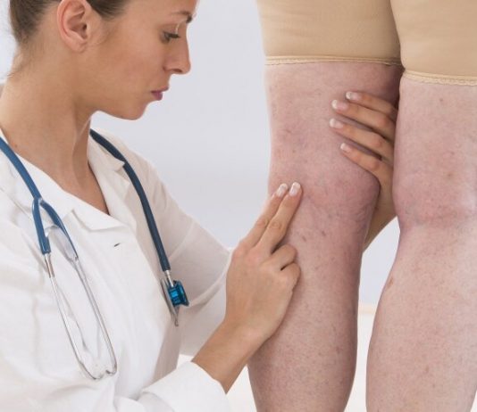 Флеболог: чем занимается специалист